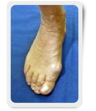 pre operatorio
